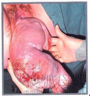 女性剖腹产全过程视频,女性分娩的勇敢之旅